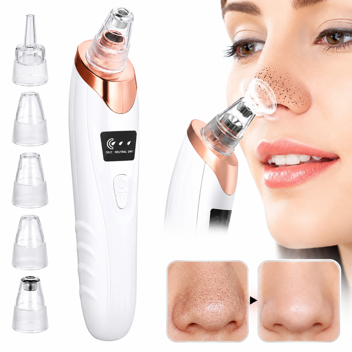 Electric Blackhead Remover Machine – Deep Pore Cleaner & Facial Suction Vacuum