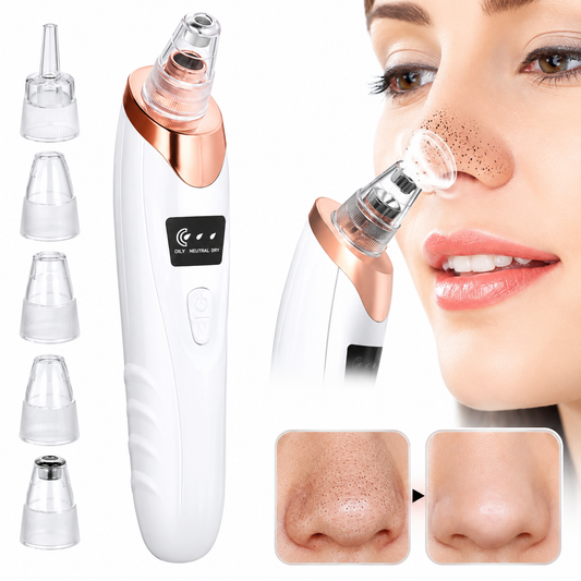 Electric Blackhead Remover Machine – Deep Pore Cleaner & Facial Suction Vacuum