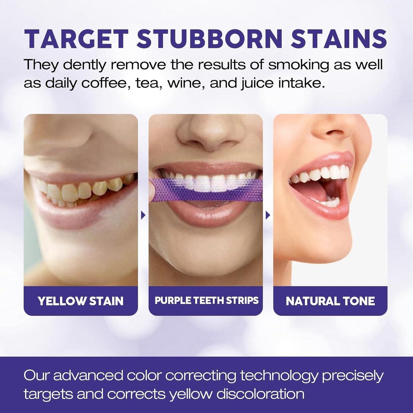 Teeth Whitening Strips – At Home Teeth Whitening Treatment