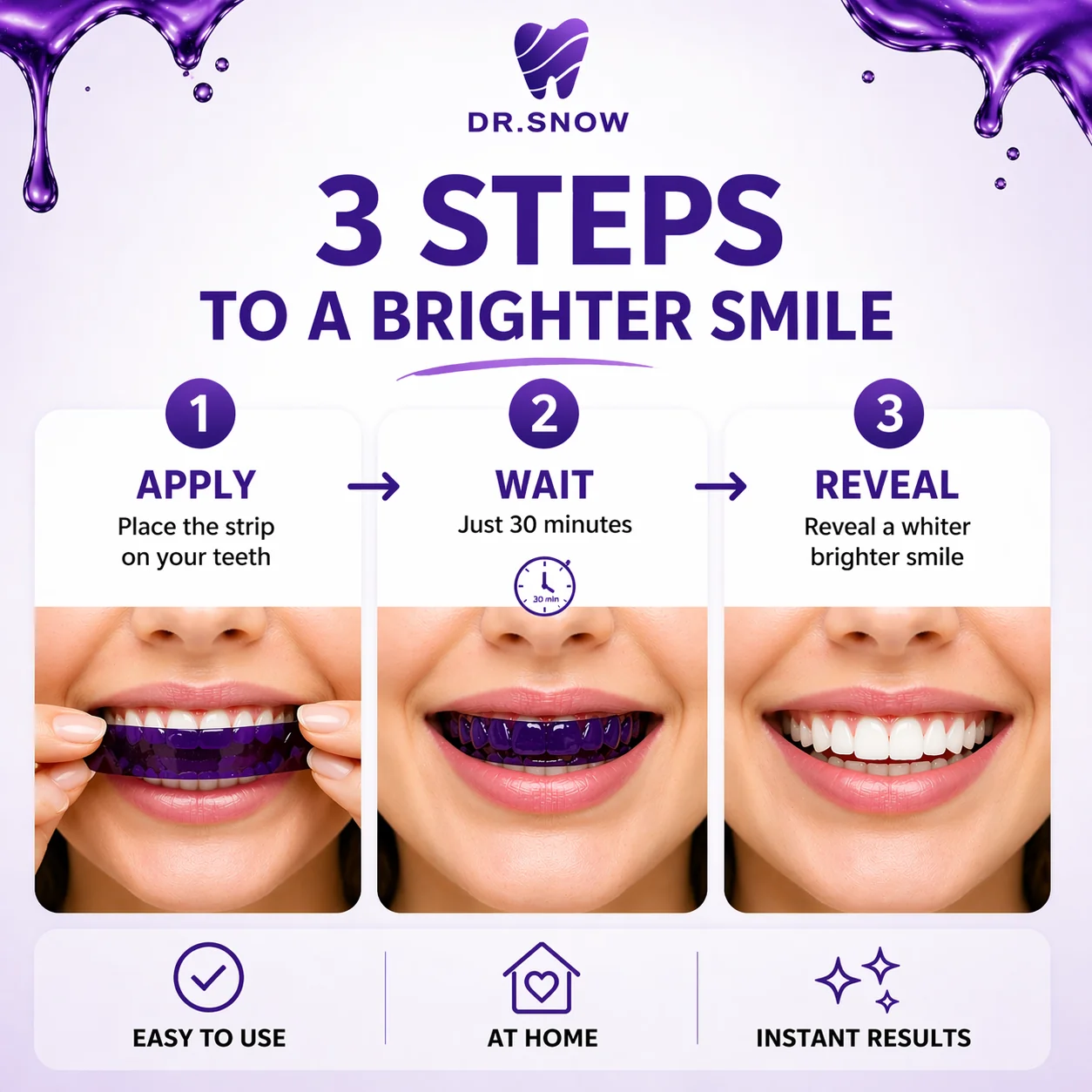 Teeth Whitening Strips – At Home Teeth Whitening Treatment