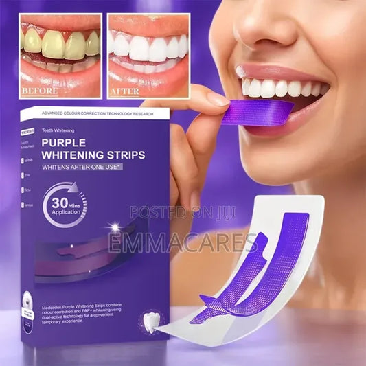 Teeth Whitening Strips – At Home Teeth Whitening Treatment